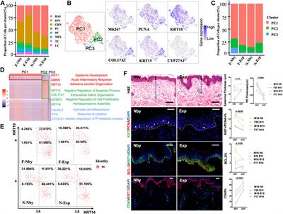 Single-Cell Transcriptomics Uncover Key Regulators of Skin Regeneration in Human Long-Term Mechanical Stretch-Mediated Expansion Therapy